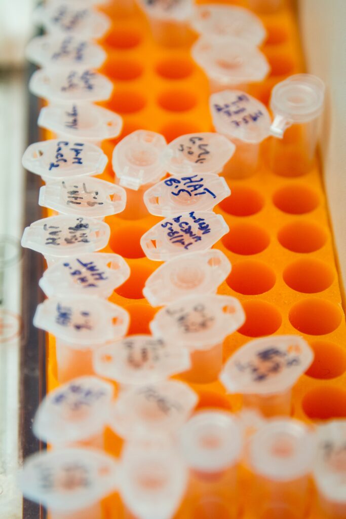 national-cancer-institute-jeT_DE3esSI-unsplash Sýnaglös í bakka